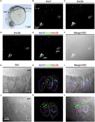 Differential expression of mechanotransduction complex genes in auditory/vestibular hair cells in zebrafish